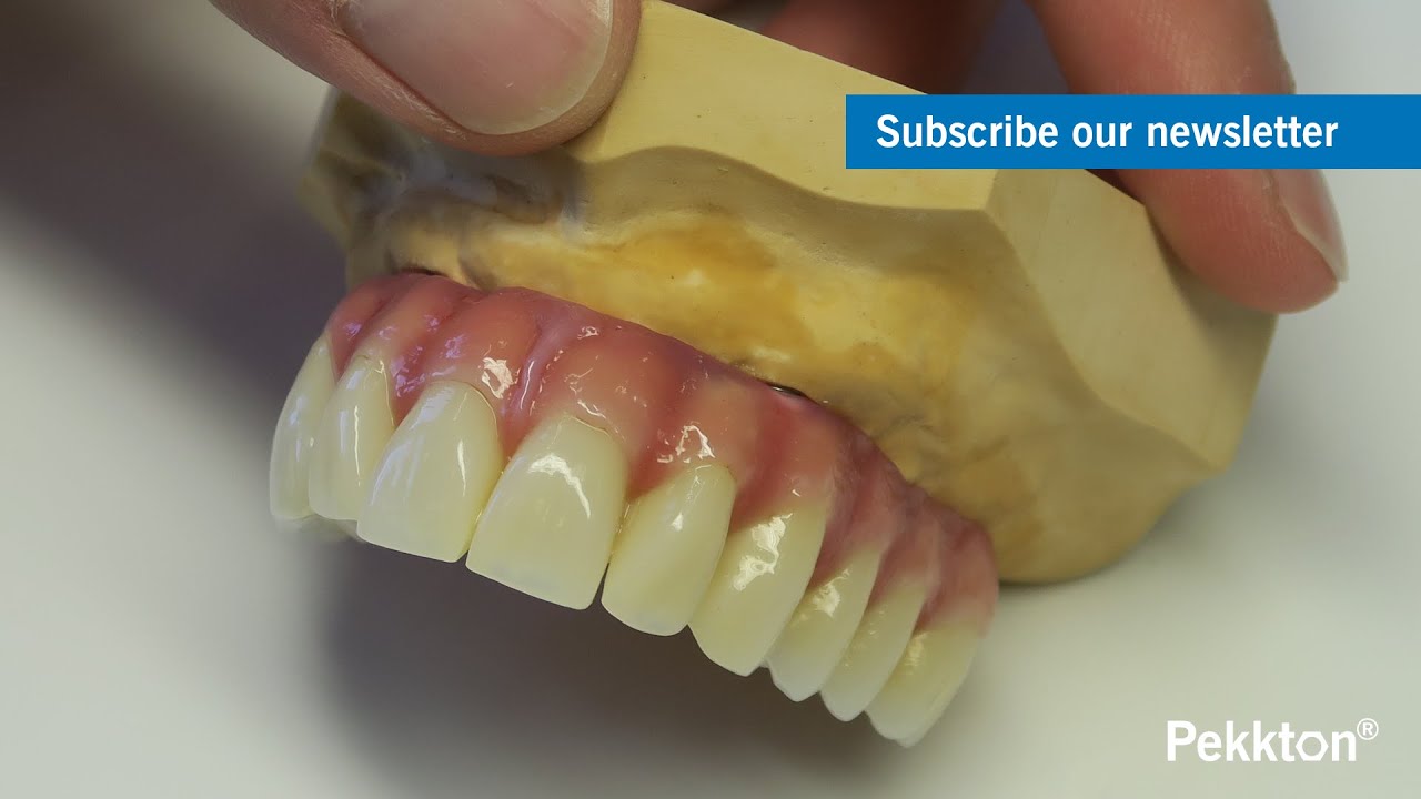 Pekkton® ivory - Step-by-Step (Press method) with anaxFORM LC Kit and Creopal Shell (EN)