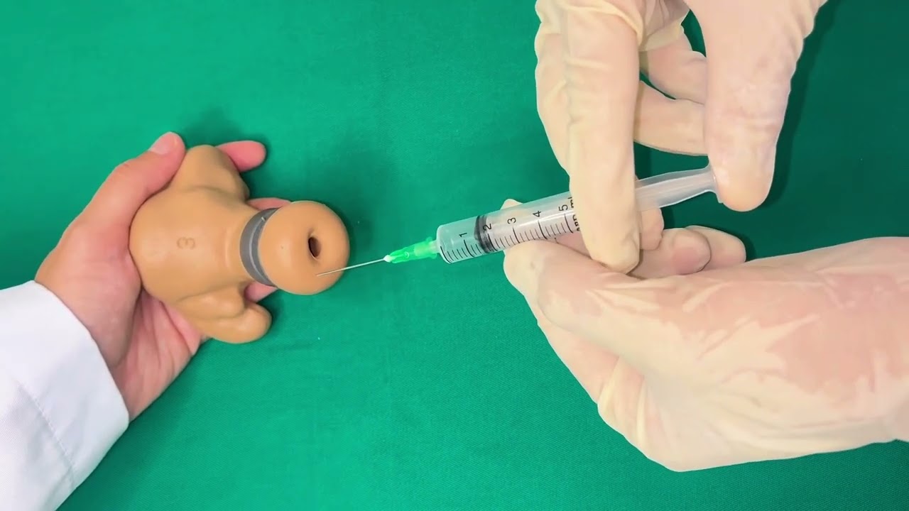 DIU (Dispositivo Intrauterino) Mirena