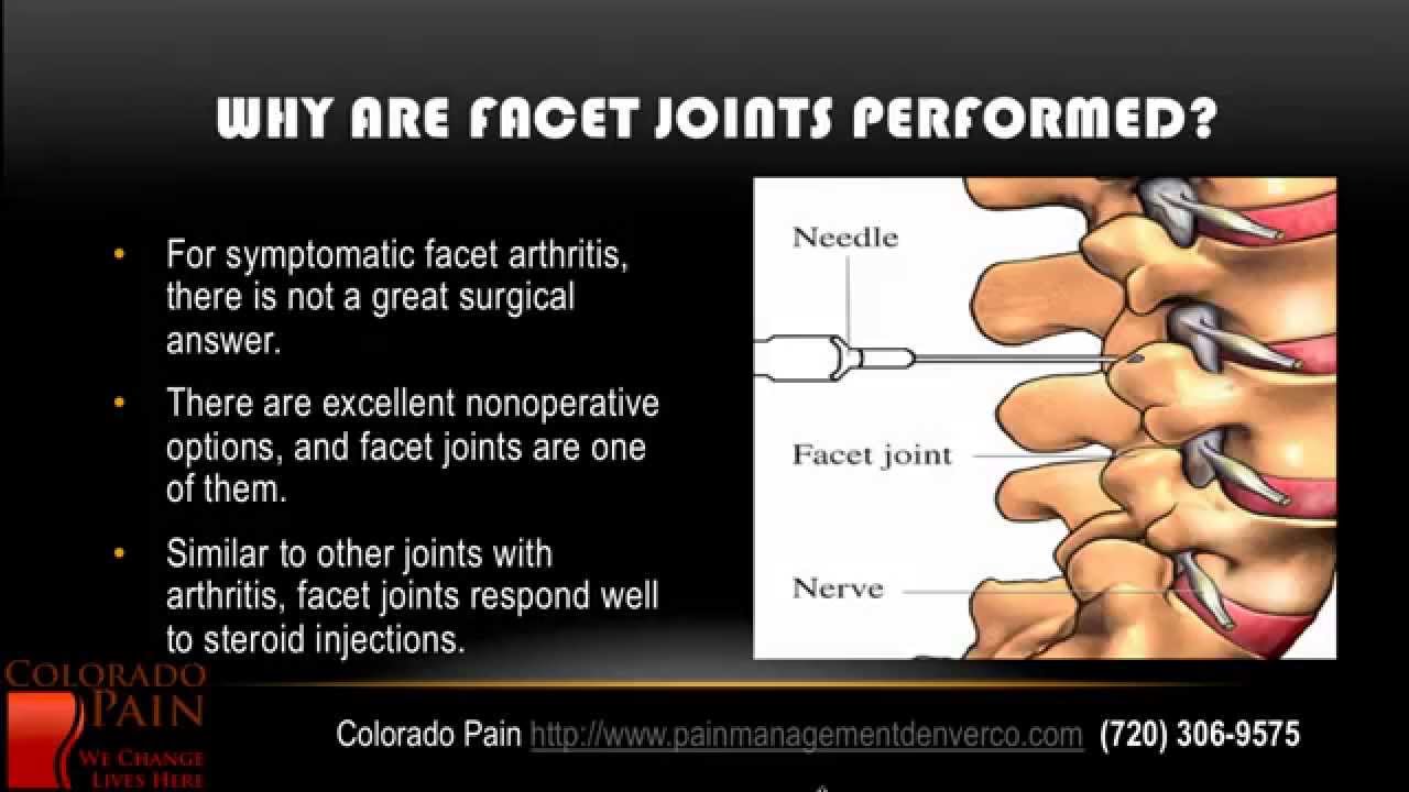 Facet Injection Overview from a Denver Pain Center  (720) 306-9575