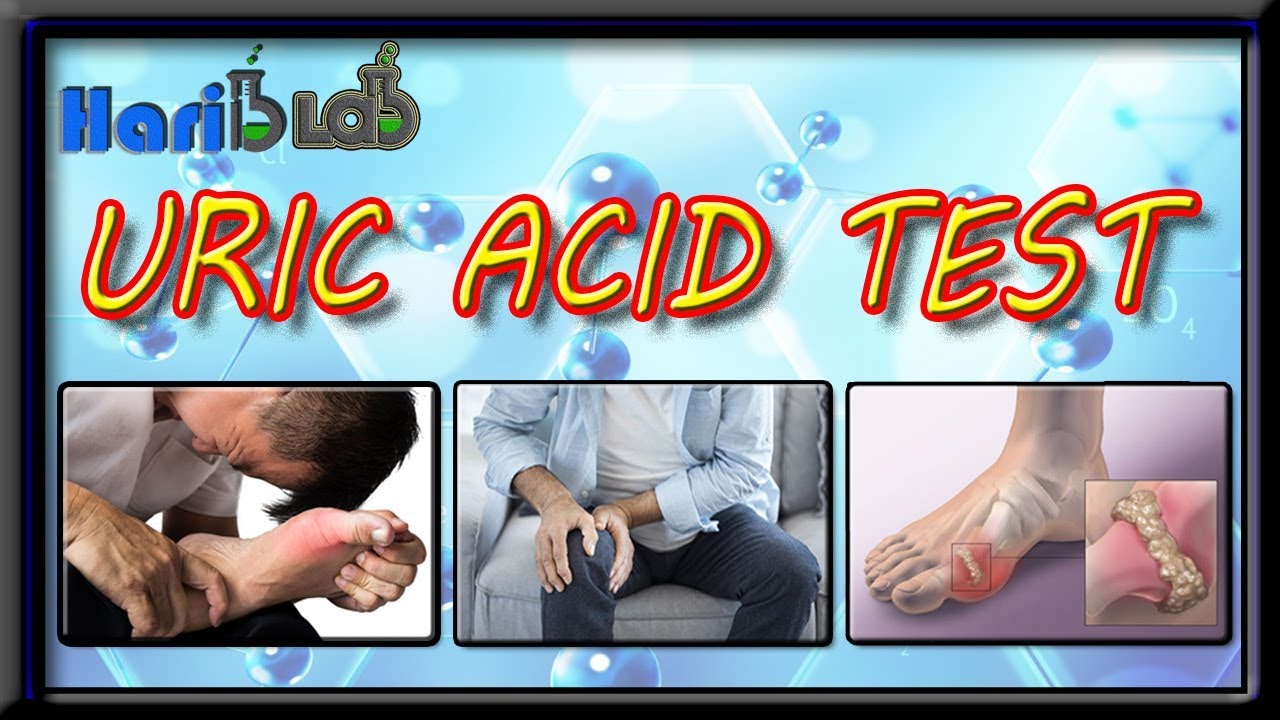 Uric Acid Test ### By Harib Diagnostic Lab