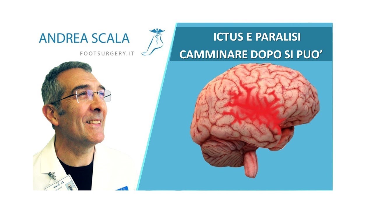 Ictus e Paralisi. Camminare dopo l' Ictus si può | Piede equino e paralitico post ictus