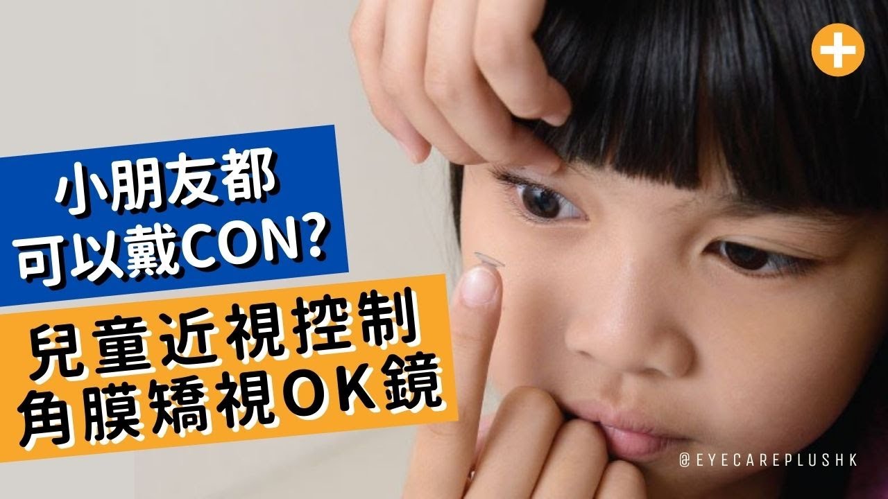 【小朋友都識自己戴CON?】兒童近視控制 角膜矯視隱形眼鏡(OK鏡)