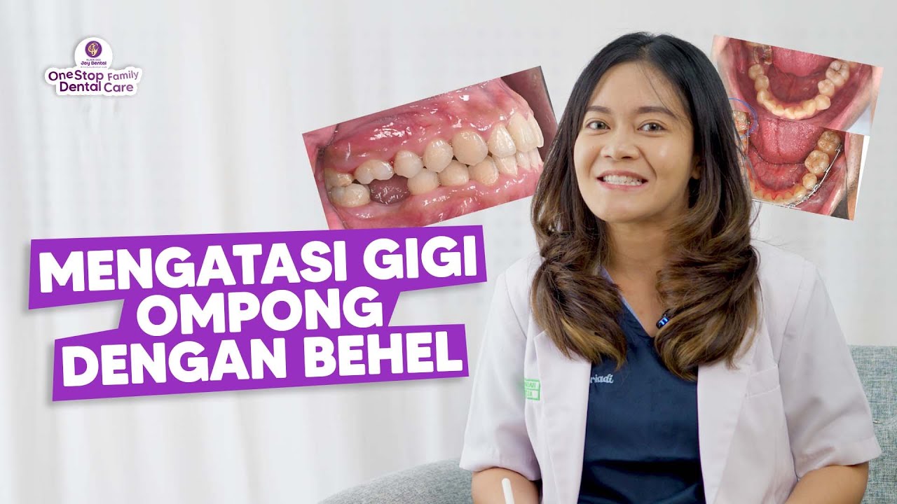 GIGI OMPONG JADI RAPET KARENA BEHEL! INI DIA PENJELASAN DARI SPESIALIS