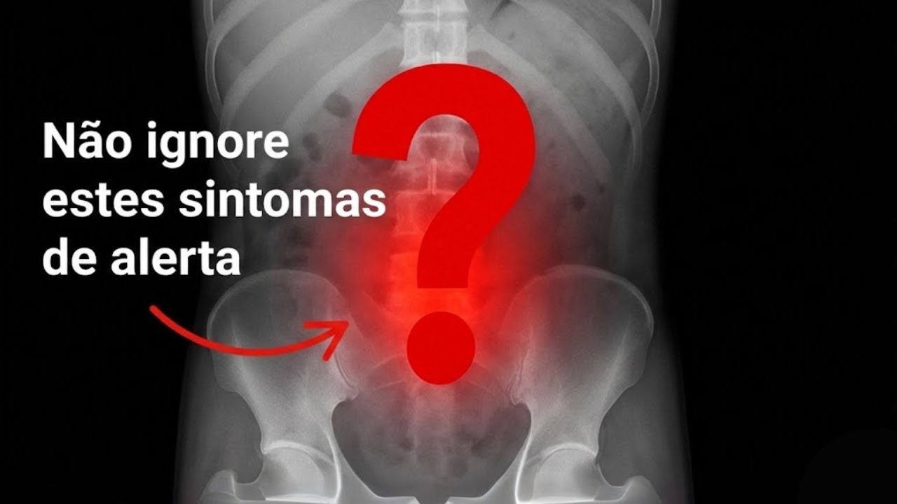 7 sinais de alerta de diverticulite que a maioria dos médicos ignora