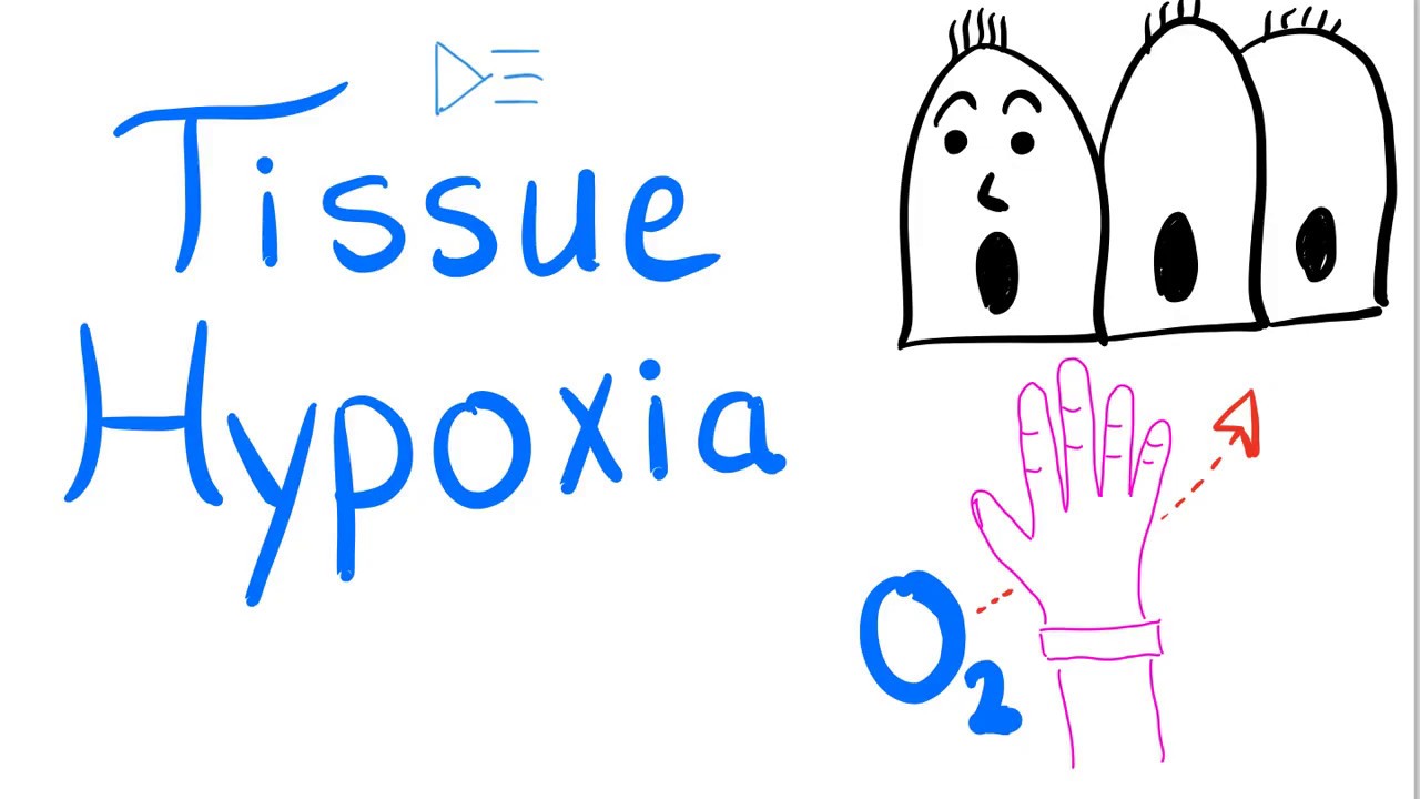 Tissue Hypoxia - Respiratory Physiology & Pathology - Pulmonary Medicine