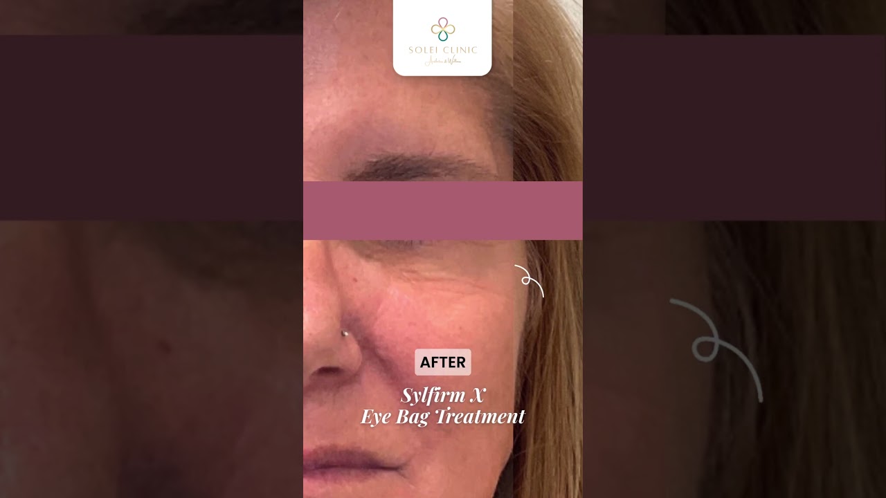 Sylfirm X Eye Bag Treatment 