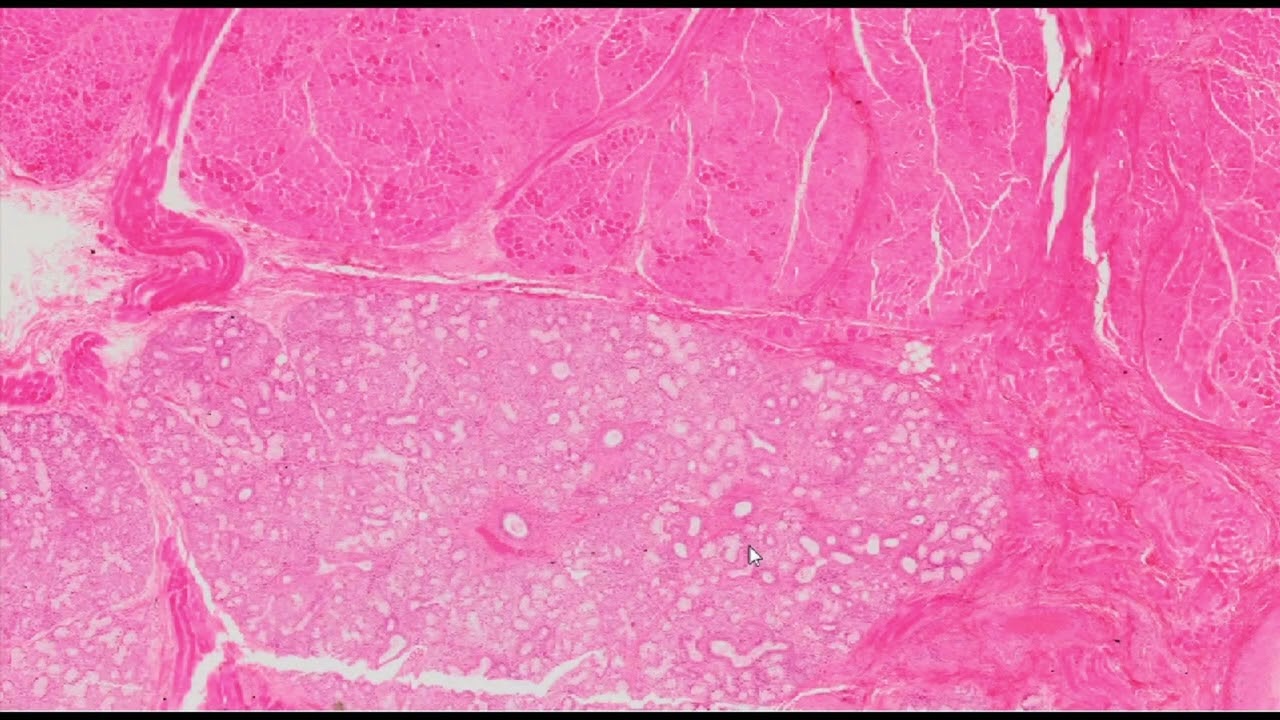The lip (H&E Staining) - PUMS Histology Slides Review Series