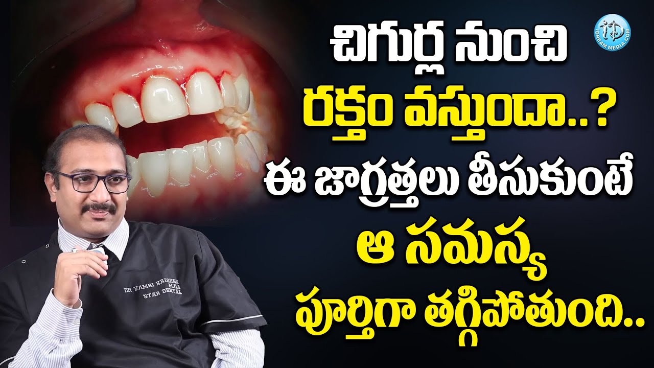 How To Stop Bleeding Gums In Telugu | Dr Vamshi krishna About Bleeding Gums || iDream Health Care