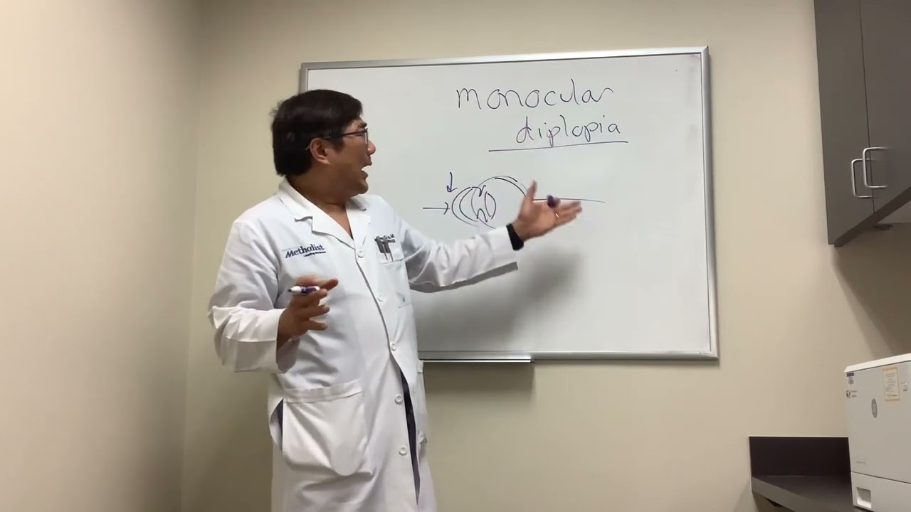 Monocular Diplopia management