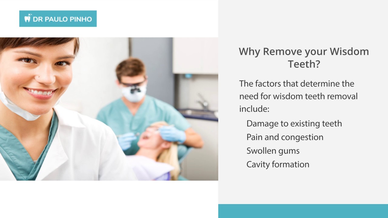 Wisdom Teeth Removal at Affordable Costs in Sydney