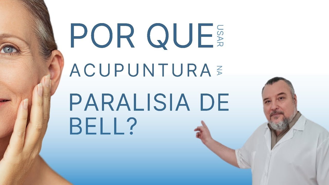 Acupuntura para Paralisia de Bell