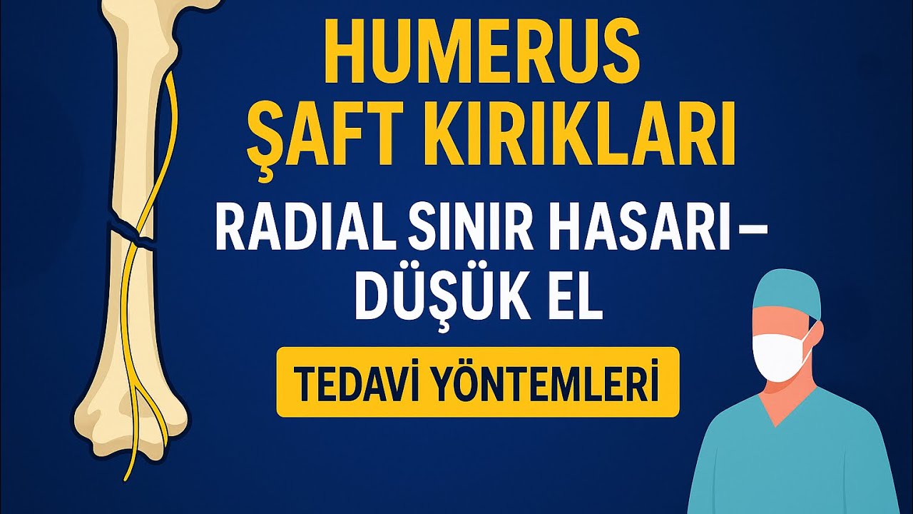 Humerus Kırıkları ve Radial Sinir Hasarı |  Düşük El Tedavisi ✔️🟢