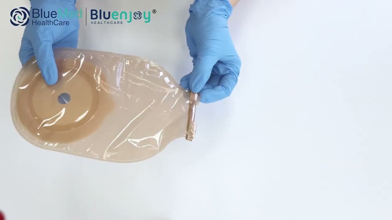 Tailored Solutions by China&rsquo;s Ostomy Expert