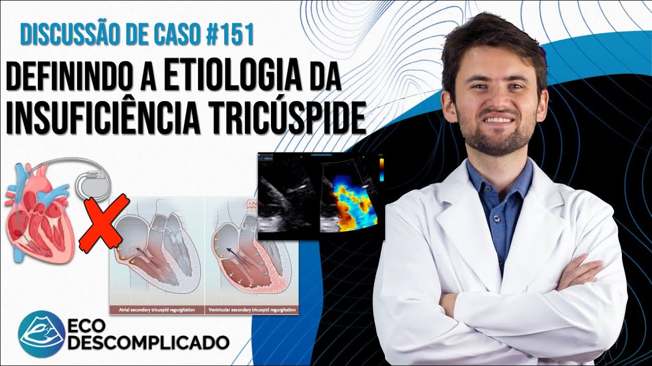 Definindo a etiologia da Insuficiência Tricúspide | EcoDescomplicado Discussão de Casos #151