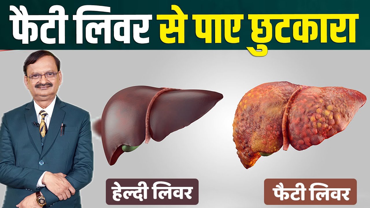 फैटी लिवर ठीक करने के ये है तगडे़ उपाय सुनिए, Subhash Goyal | Fatty Liver