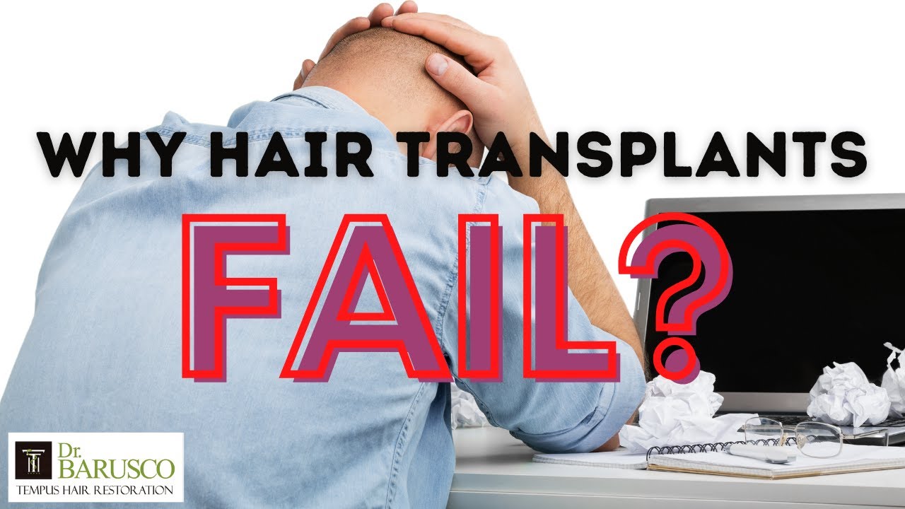 Why Hair Transplants Fail?