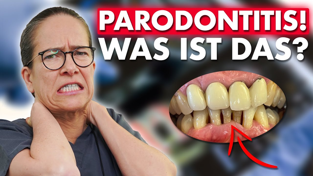 Parodontose - 3 eindeutige Anzeichen (sofort handeln) Bildmaterial