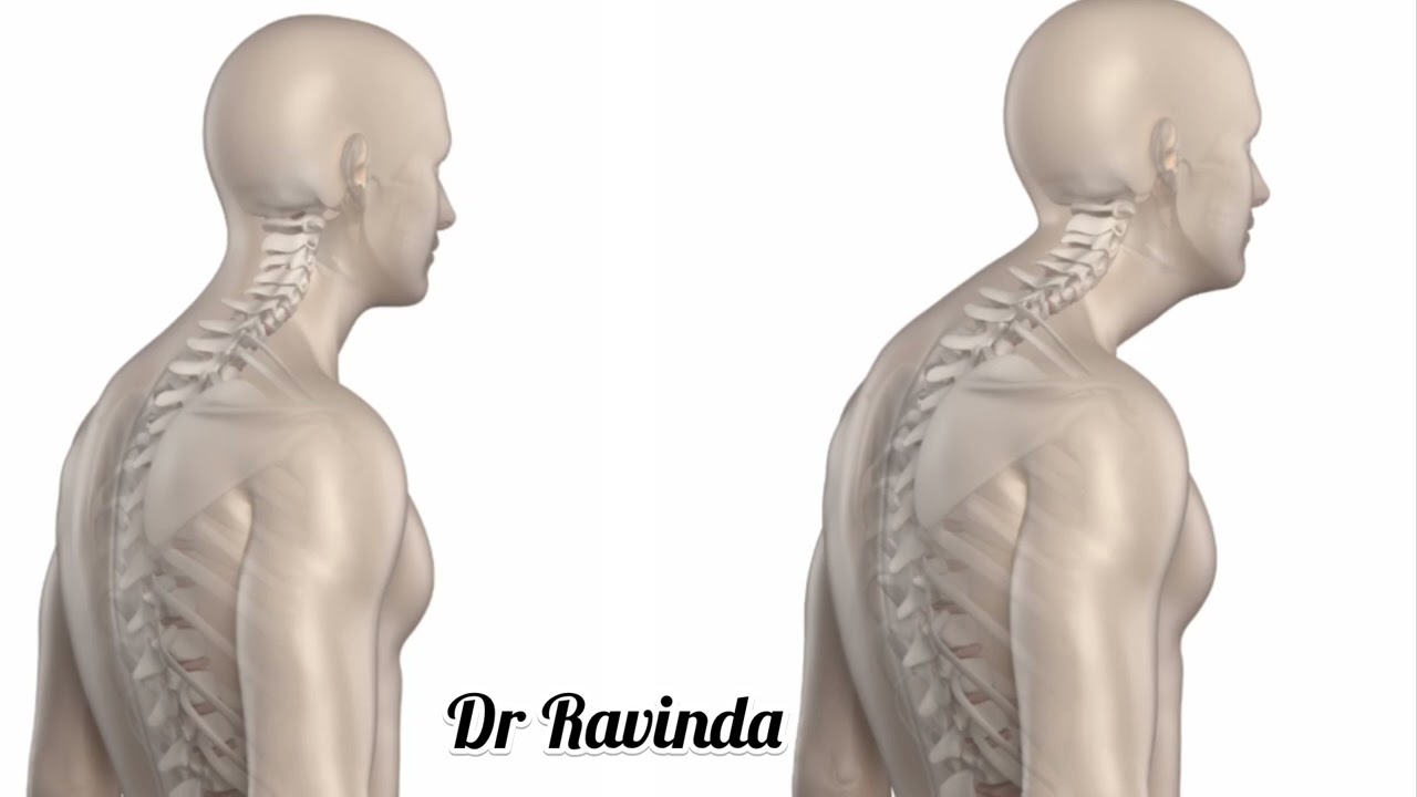 සබද අපි “කුදු