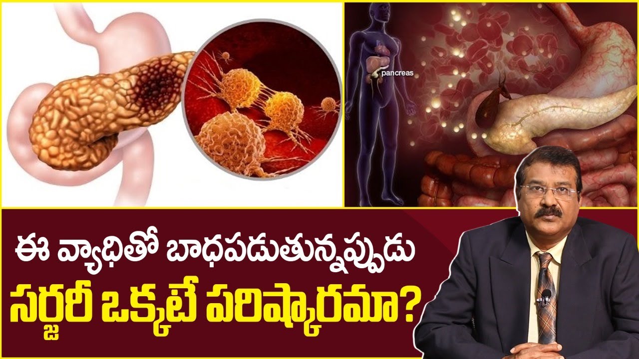 Is surgery the solution to this disease? | Surgery For Pancreatitis in Telugu | Dr DVL Narayan Ra...
