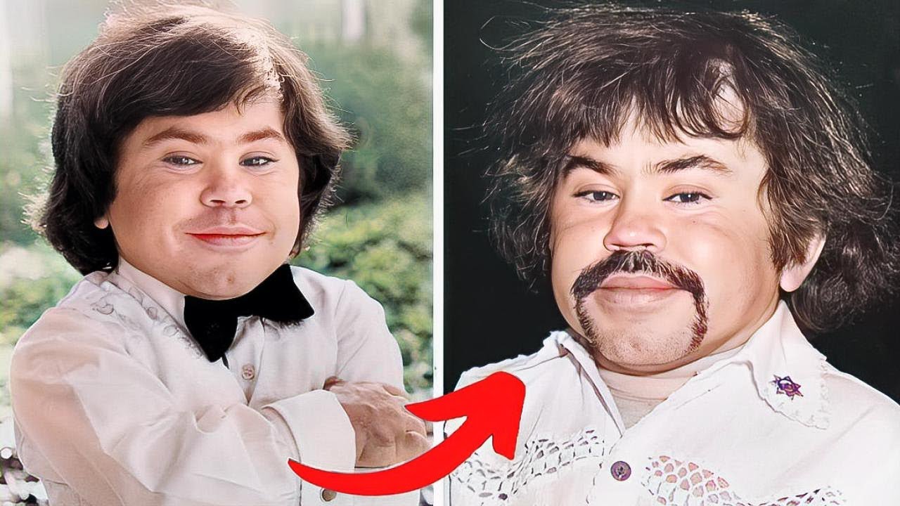 La Trágica Vida Y Muerte De Tattoo Hervé Villechaize Actor de la Isla de la Fantasia