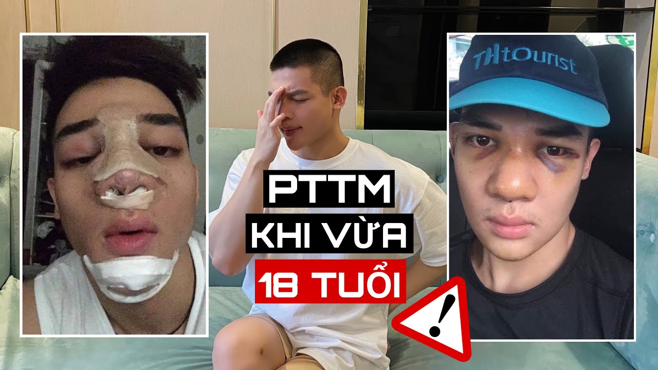 MŨI MÌNH ĐANG BỊ TUỘT SÓNG ? Tâm Sự Về Lần Đầu Đau Như “Chết Đi Sống Lại