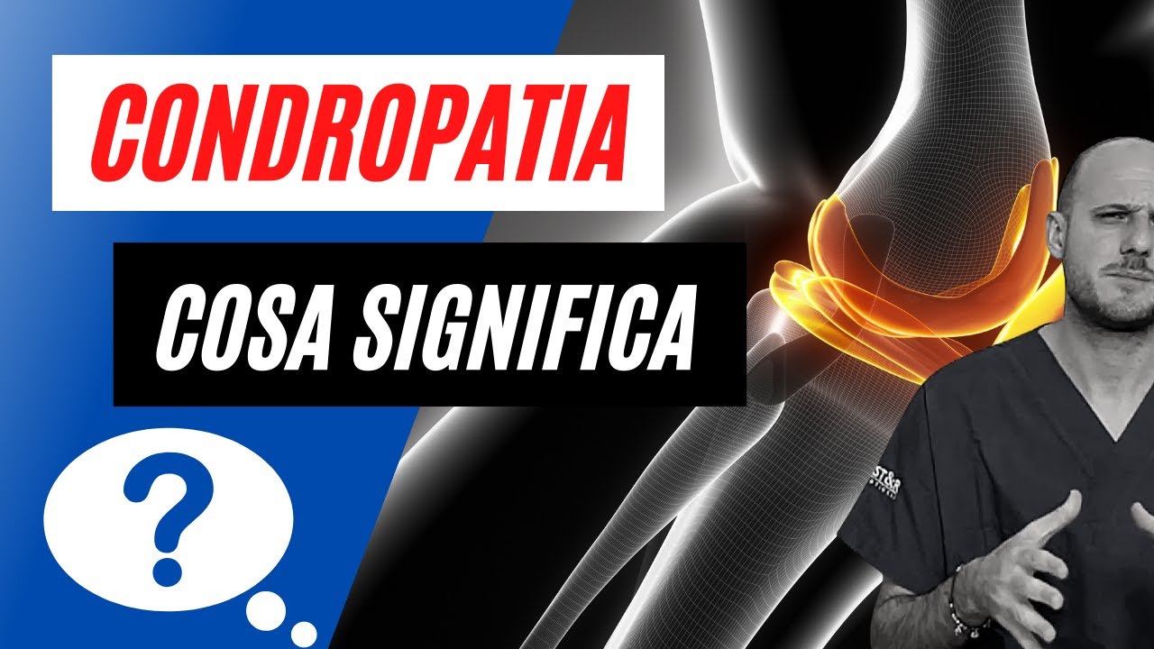 CONDROPATIA al GINOCCHIO | Cos'&egrave; e perch&egrave; ne soffri ⚠️