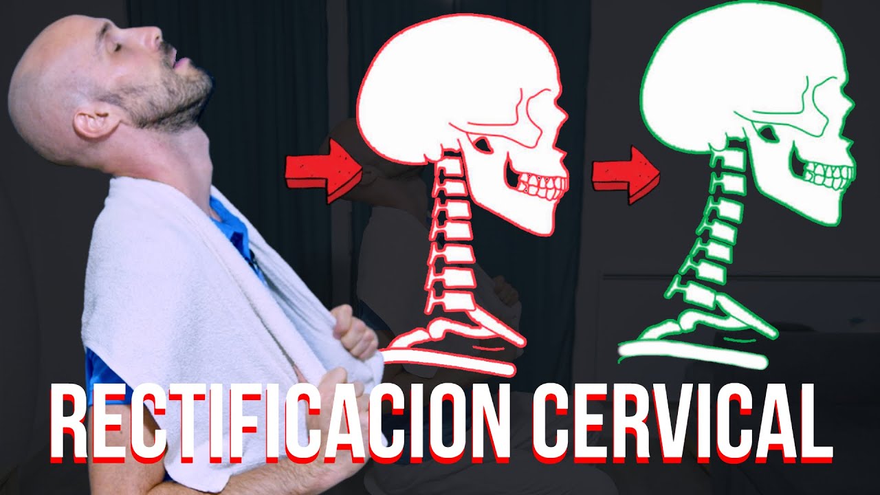 El MEJOR ejercicio para la RECTIFICACION CERVICAL
