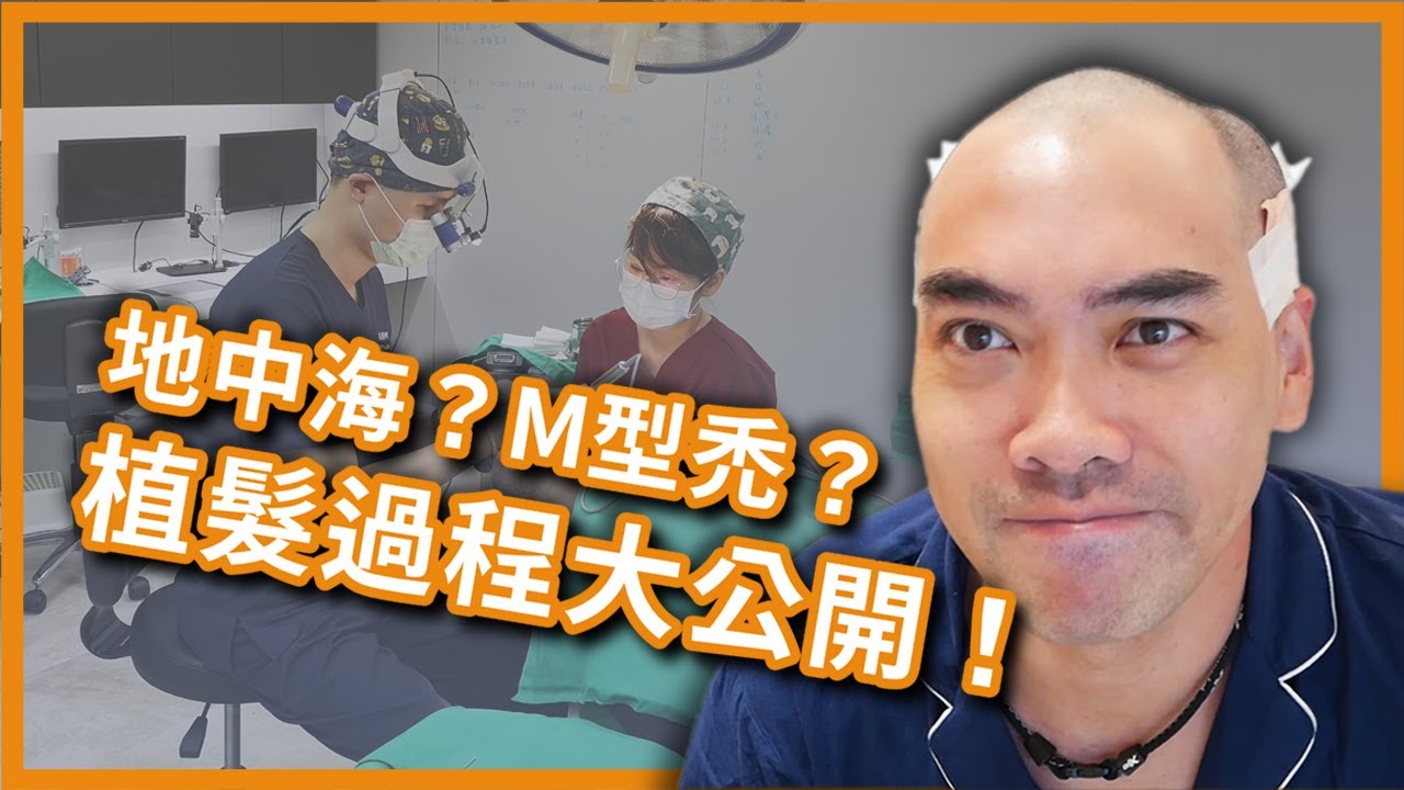植髮日誌｜搶救毛囊大作戰！告別M型禿、地中海！