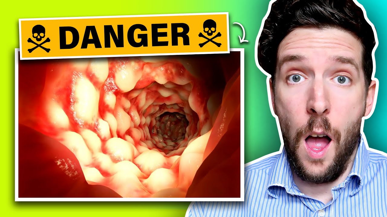 #1 Gut RISK For Vegans