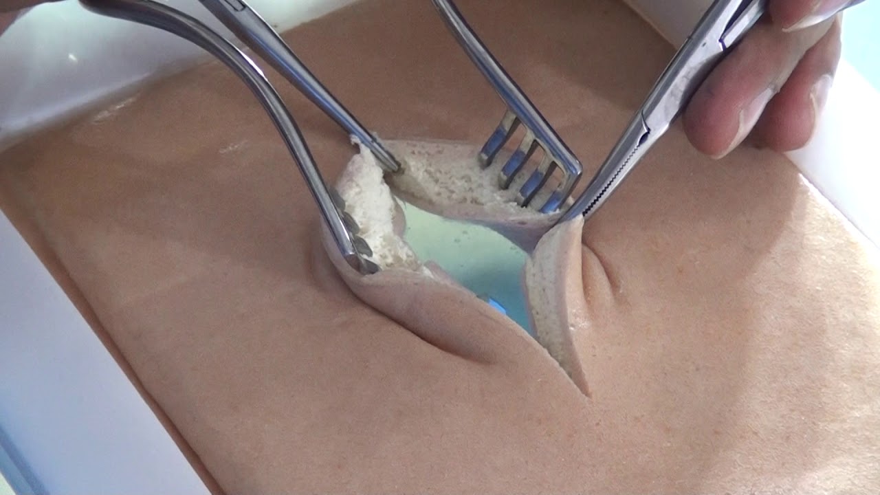 Basic Surgical Skills by Dr. Chintamani part 9