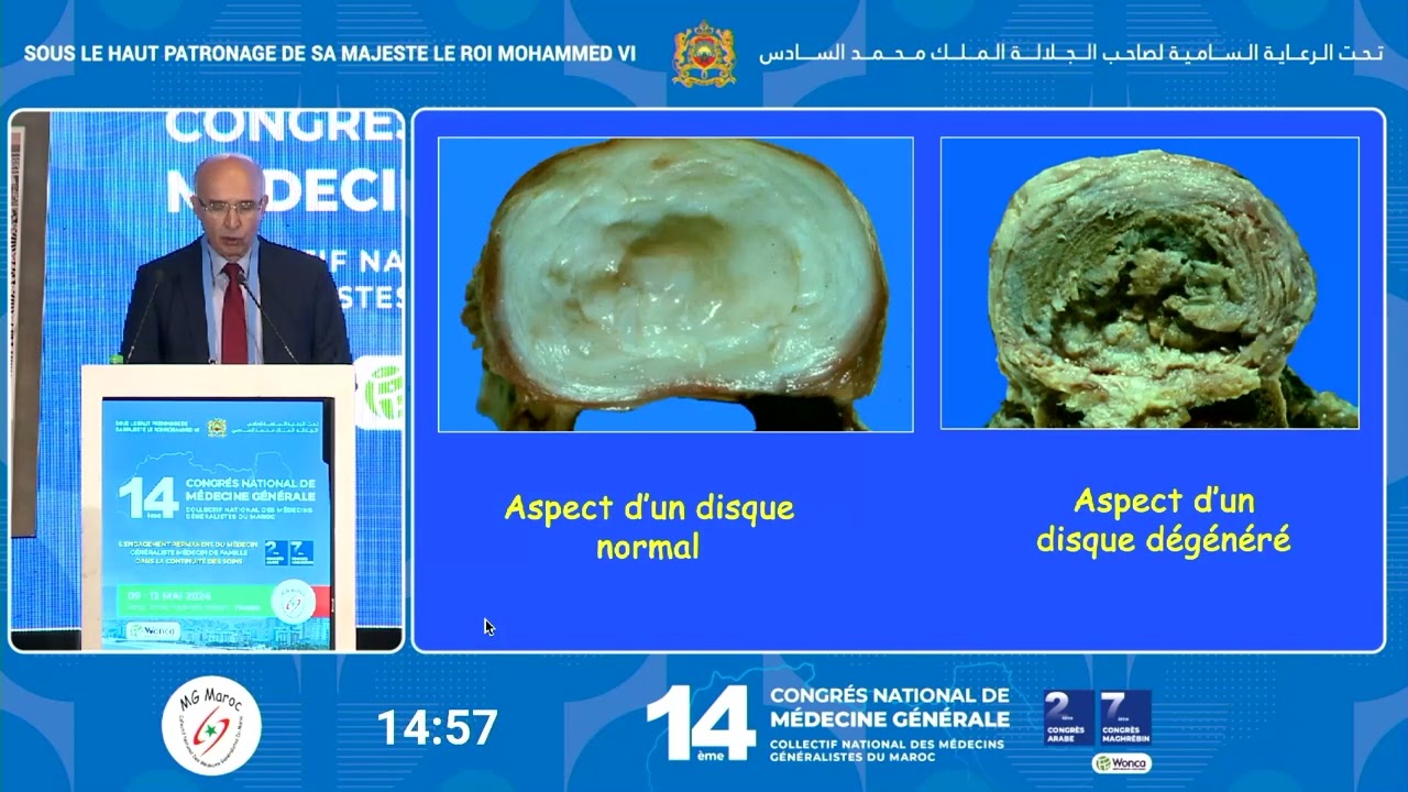 8 Les lombalgies Pr Mustapha FADILI