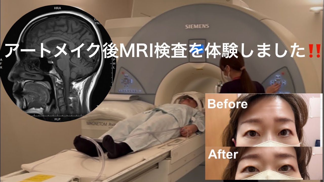 アートメイク後のMRI 検査を体験しました‼️