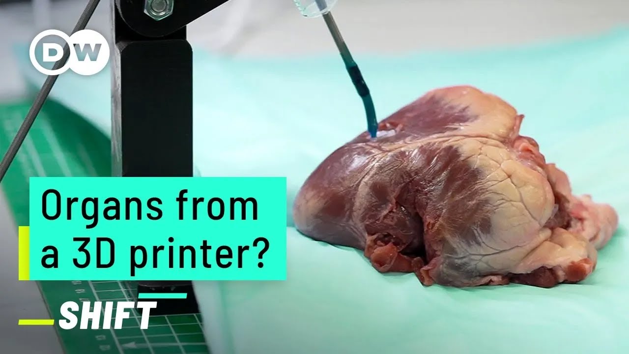 3D-printed hearts: A revolution for organ donations?