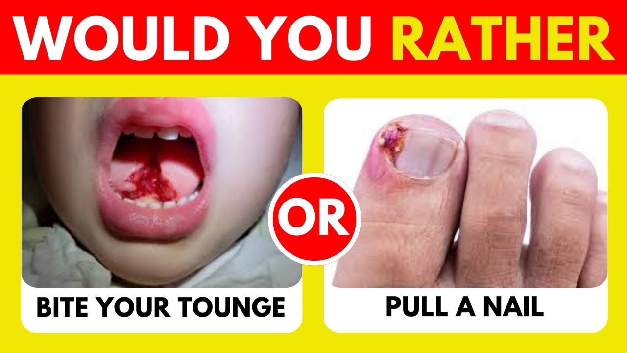 ⚡ Would You Rather...? 60 HARDEST Choices Ever! 🔥😱🧠 EXTREME Edition🧠NEXO QUIZ