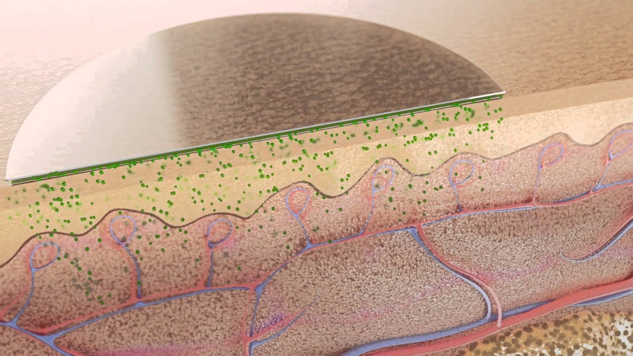 The patch as a therapeutic system