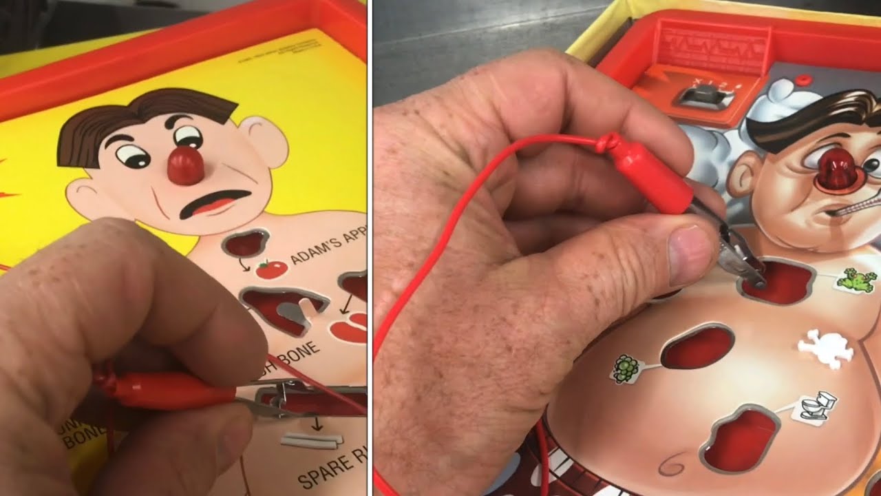 the STORY behind the “game of operation”