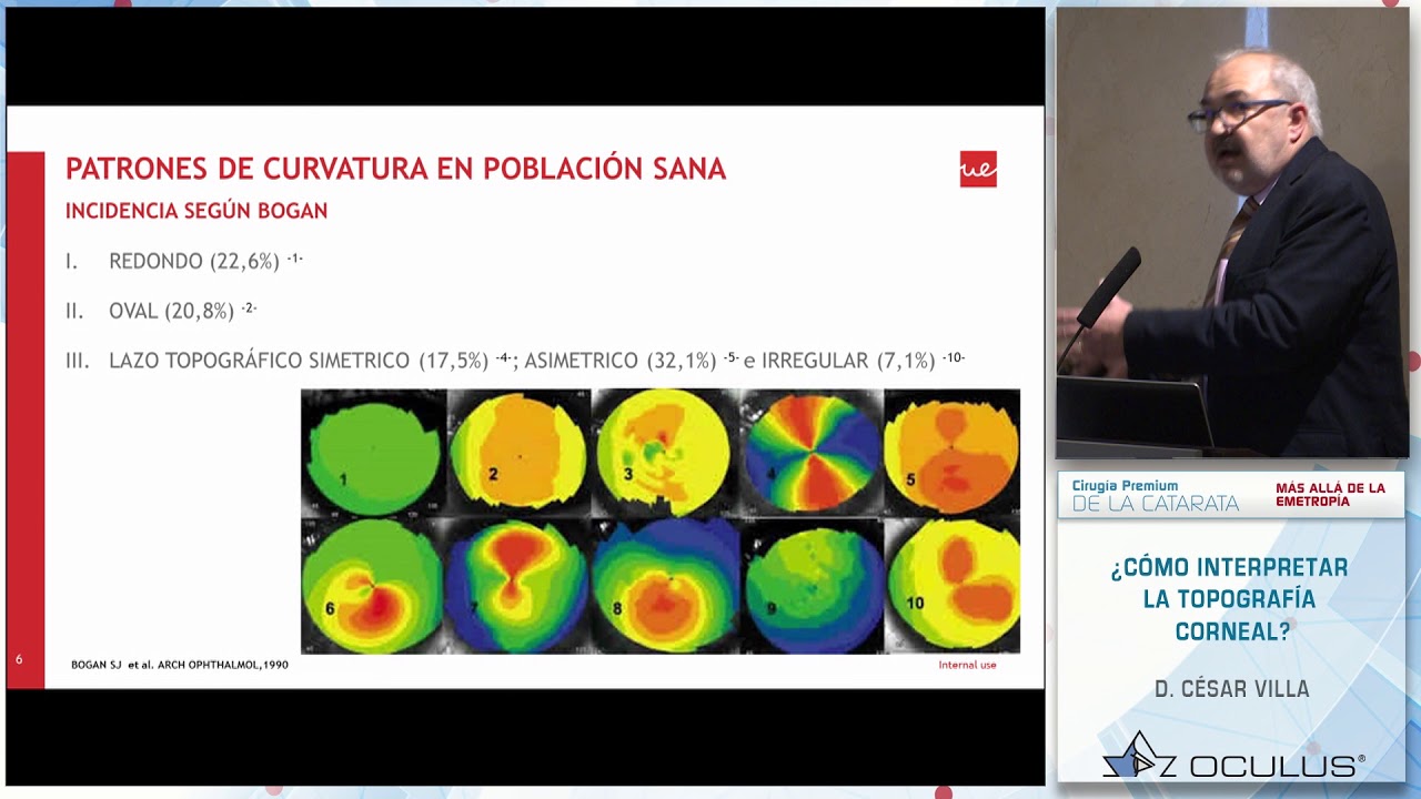 D. César Villa: ¿Cómo interpretar la topografía corneal?
