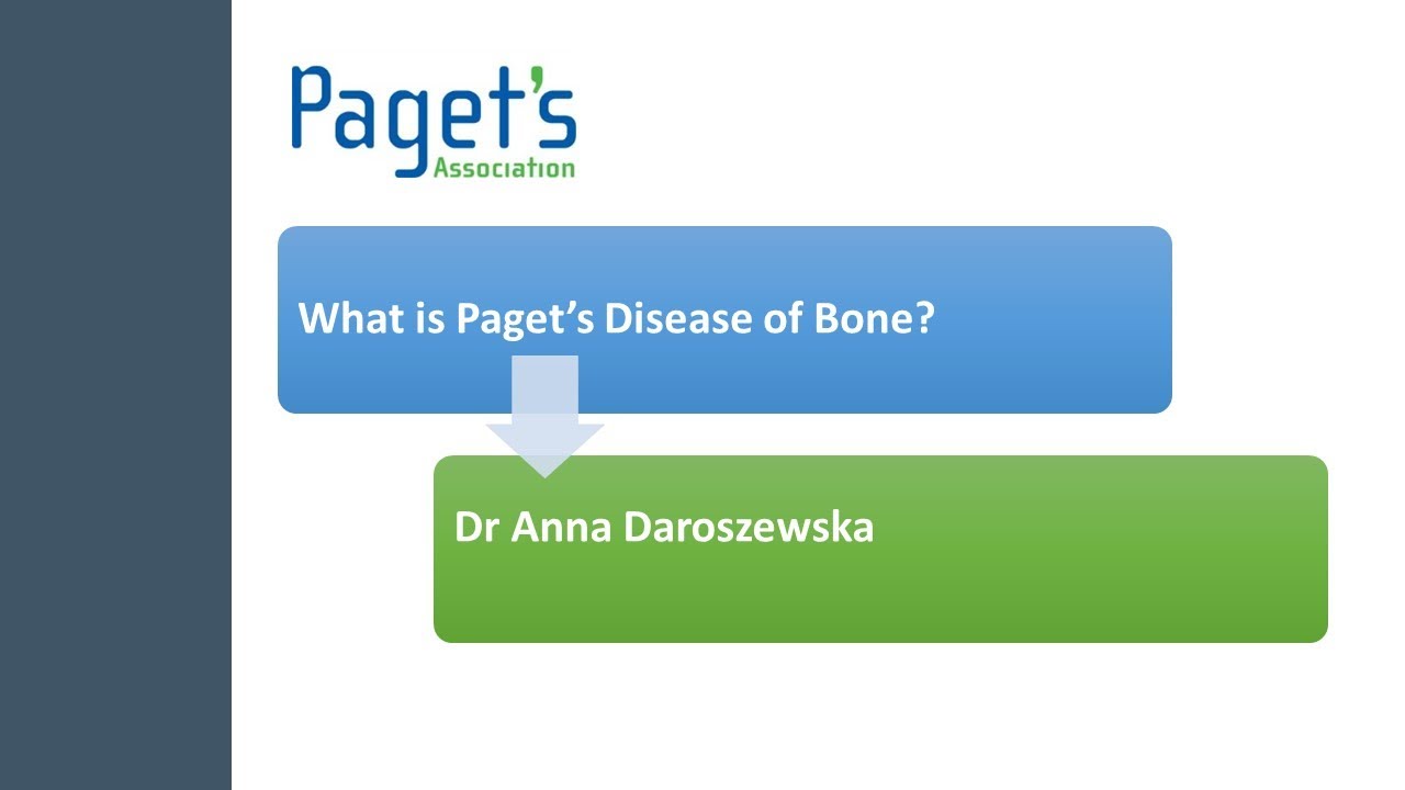 Exactly what is  Paget's Disease of Bone?