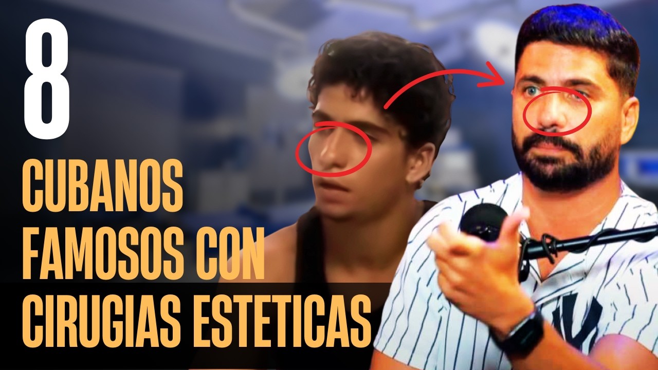 8 Famosos Cubanos que se Han Hecho Cirugías Estéticas 😱 | ¡Antes y Después!
