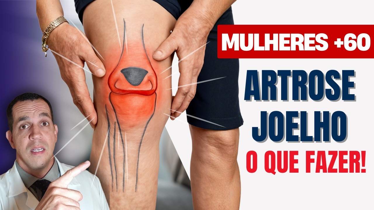 Risco de Artrose em mulheres acima dos 60 anos - o que fazer