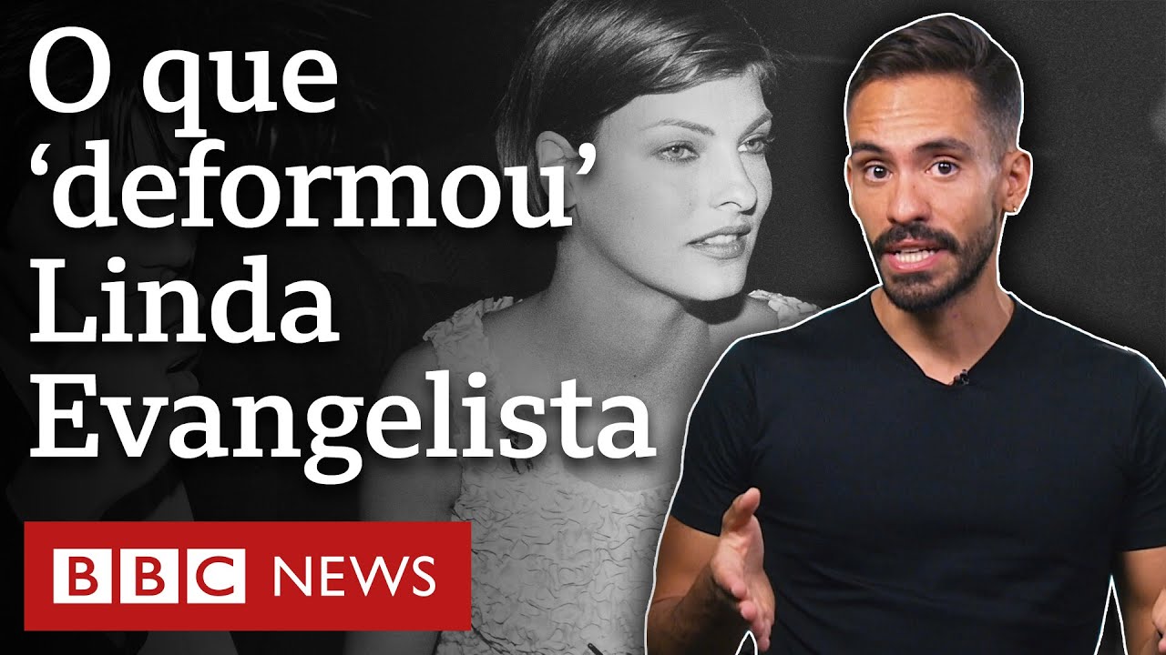 Criolipólise, o procedimento estético que 'deformou' modelo Linda Evangelista