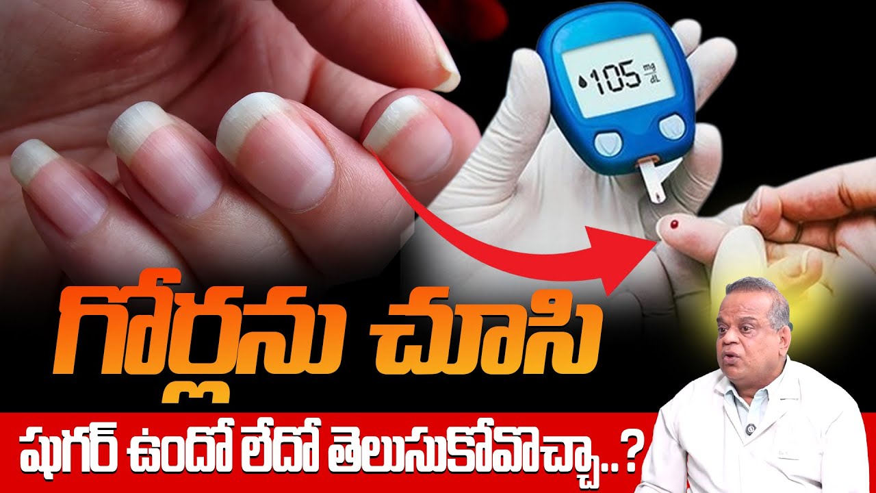 గోర్లను చూసి షుగర్ ఉందో లేదో తెలుసుకోవొచ్చా..? : Diabetes Symptoms Telugu | SumanTv Swapna