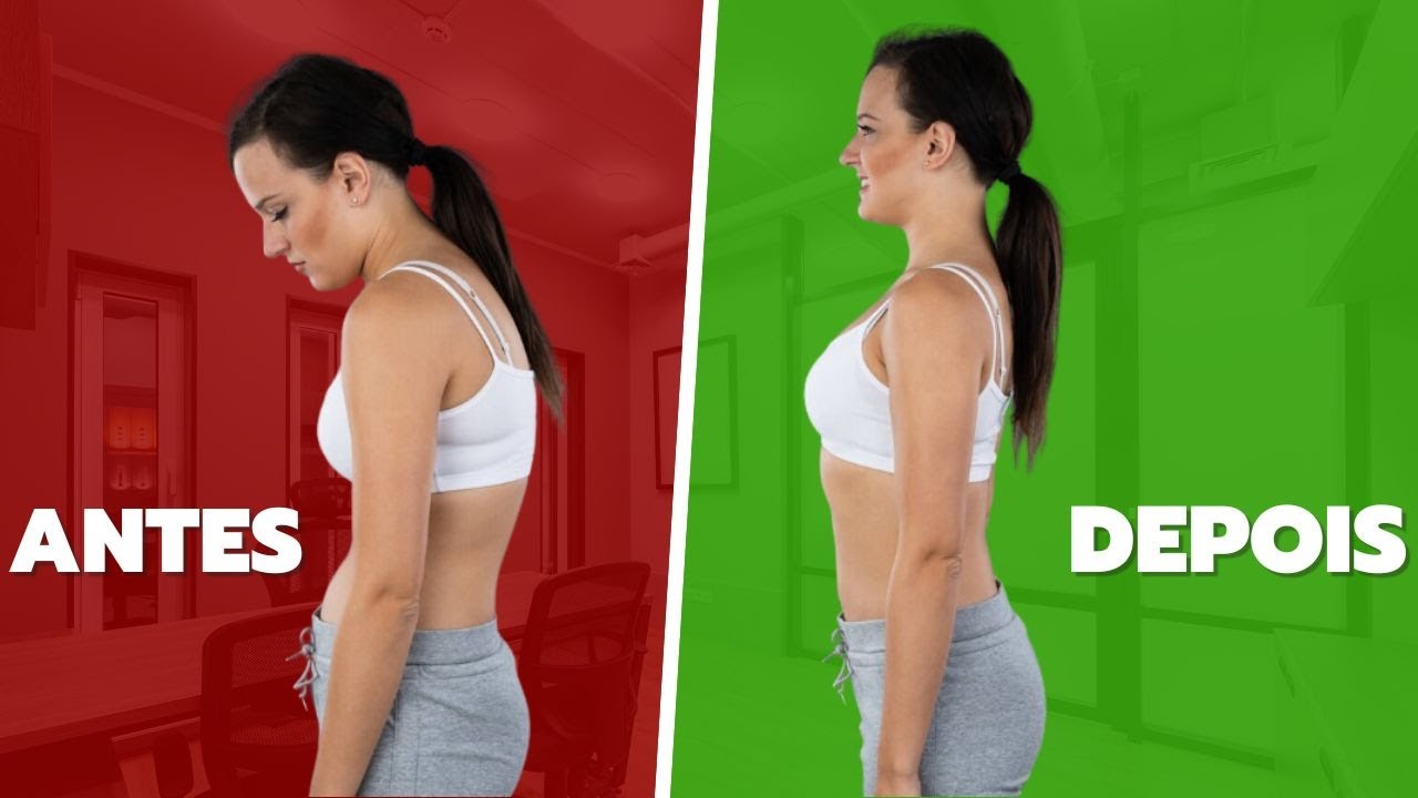 Corrija a HIPERCIFOSE com ESSE Exercício - Face Pull