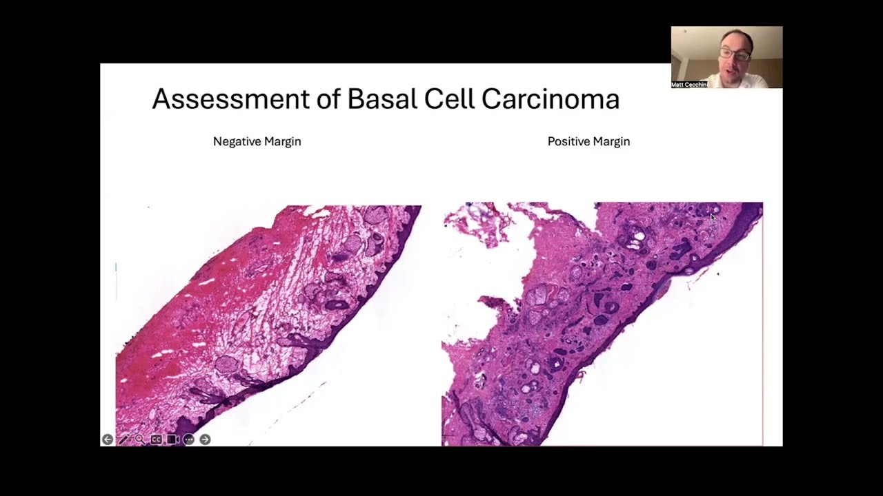 Unlocking the data behind the glass to empower the agentic future of pathology