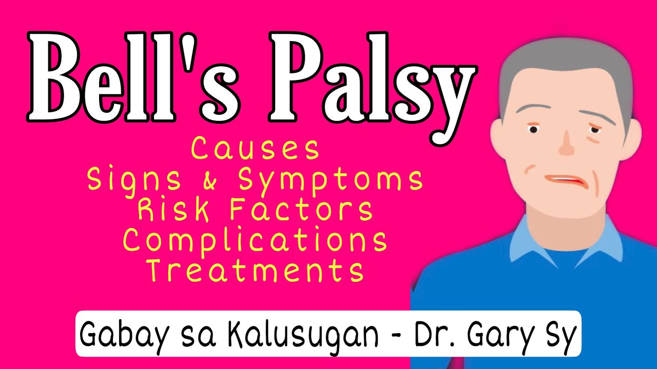 Bell's Palsy: Causes, Signs, Symptoms, Diagnosis & Treatments - Dr. Gary Sy