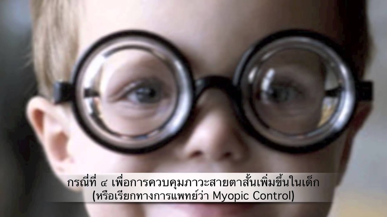 CLURU:คอนแทคเลนส์สำหรับเด็ก