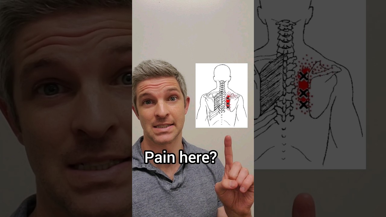 Rhomboid Pain Relief! - 3 Proven Exercises