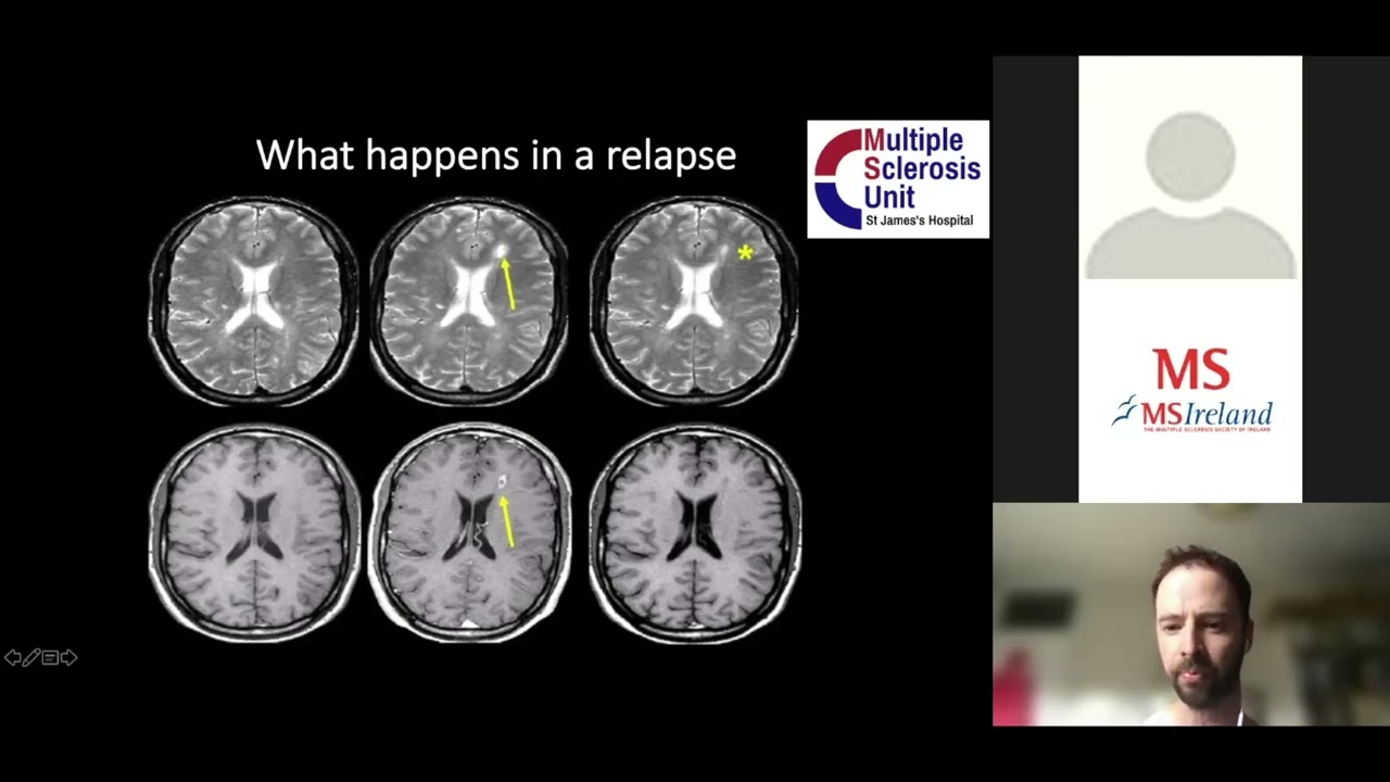 Relapses Webinar
