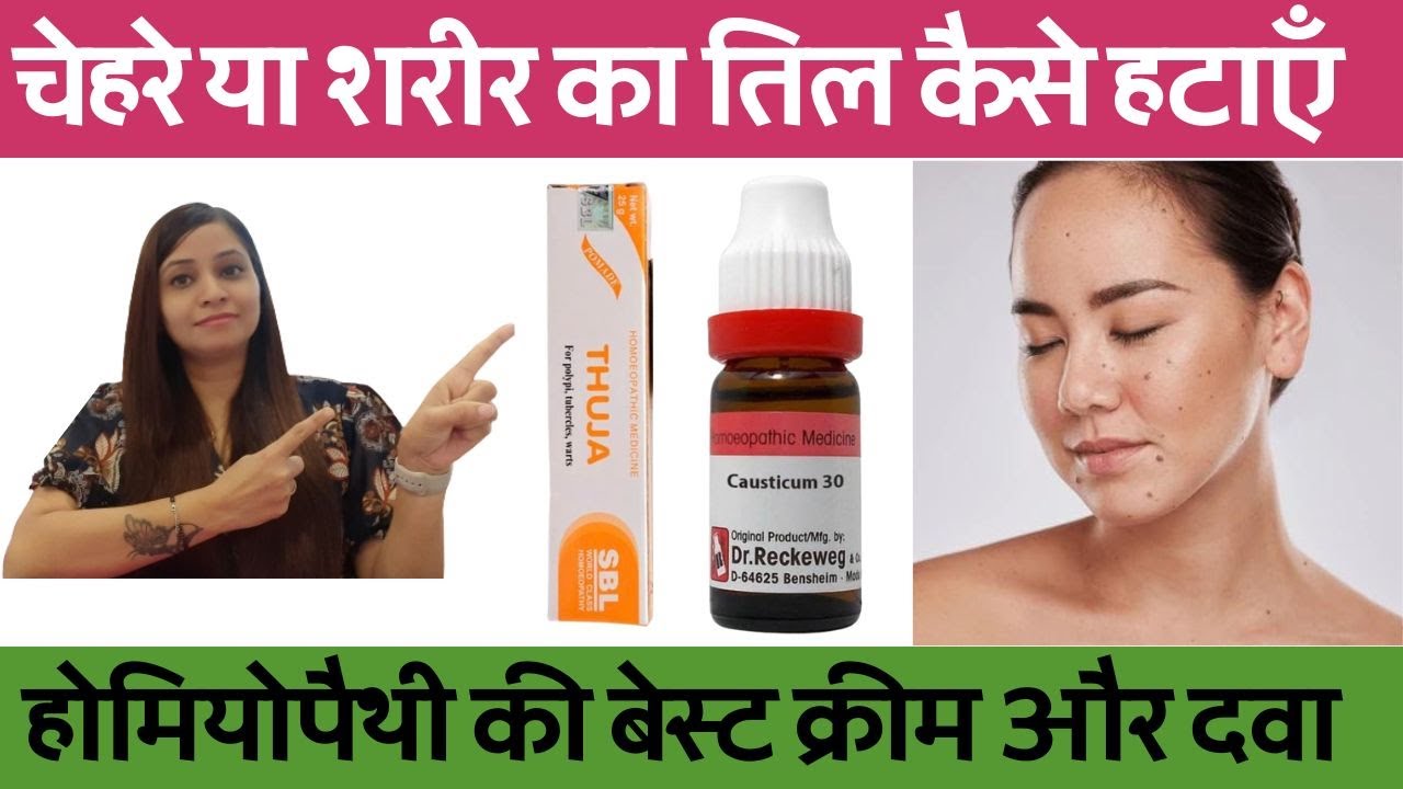 तिल हटाने का तरीका | तिल हटाने के उपाय | chehre ke til ka ilaj |तिल हटाने की दवा |तिल हटाने की क्रीम