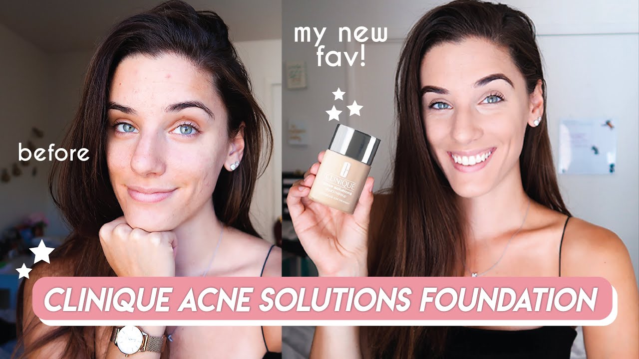 Natural Looking Foundation for Acne? | CLINIQUE ACNE SOLUTIONS FOUNDATION REVIEW + DEMO
